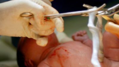 Cord Blood Banking Myth: Cord Blood Doesn’t Last Very Long in Storage