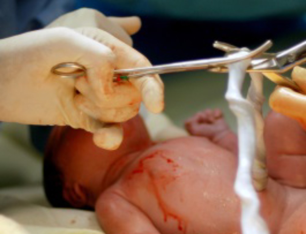 Cord Blood Banking Myth: Cord Blood Doesn’t Last Very Long in Storage