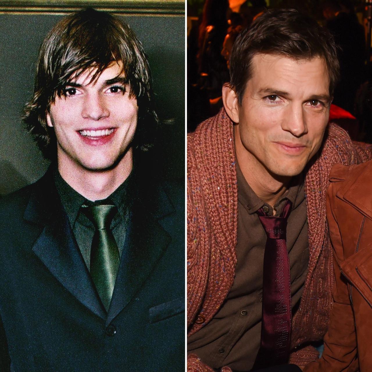 Did Ashton Kutcher Have Plastic Surgery? A Comprehensive Analysis Did Ashton Kutcher Have Plastic Surgery? A Comprehensive Analysis