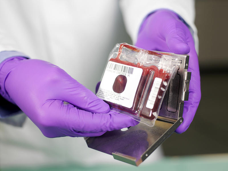 Cord Blood by cryocordcell00 - Issuu